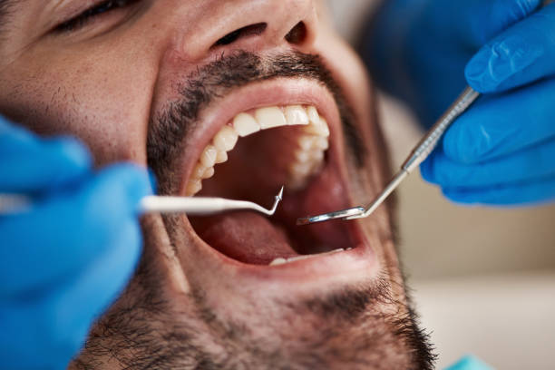 Best Emergency Denture Repair in Lewisburg, PA